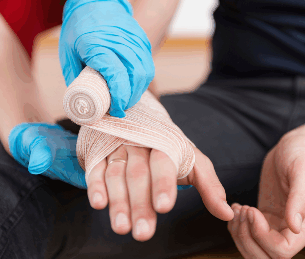 Burn injury personal injury claims: Your rights and how we can help